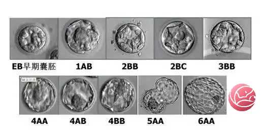 上海捐卵多少钱,上海捐卵试管有无风险_代怀最高年龄