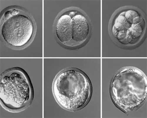 上海仁济医院供卵流程,上海仁济-供卵过程_做代怀医院