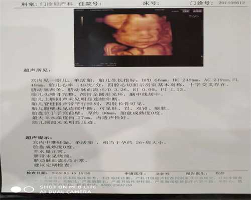 上海代孕最好的中心,上海闵行月子中心哪个好 坐月子可以吃什么水果