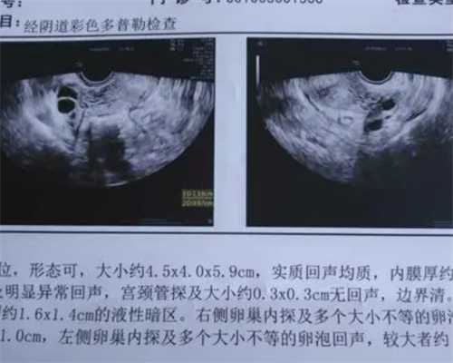 上海红房子医院试管需要多少钱？上海试管婴儿费用影响因素是什么？