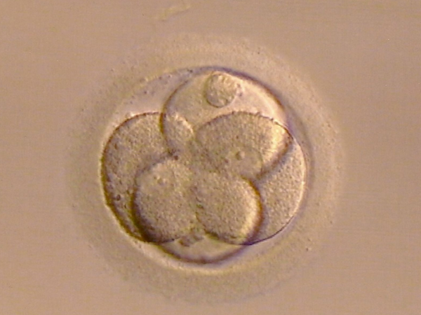 详解试管囊胚培养5天和6天的区别，发育程度是其一