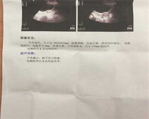 上海急寻代孕，上海三代试管价格，上海试管代孕代孕生费用