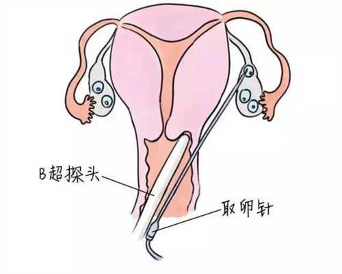 上海合法代孕-上海供卵试管-在中国有合法上海代孕途径吗