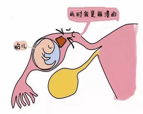上海代孕包儿子_助孕风险大吗_助代怀孕包男孩