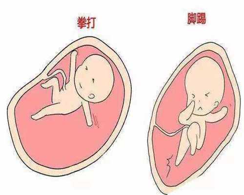 添丁助孕公司-上海代孕包性别_21三体综合征患者做第三代试管要多少钱？